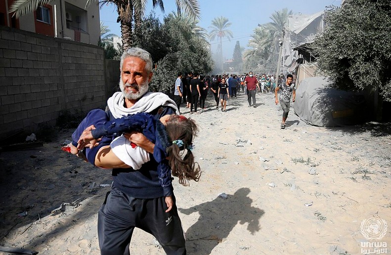 Injured Palestinian by an Israeli airstrike